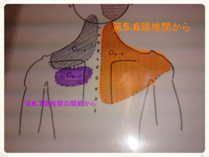 頸椎から肩甲骨への痛みの図