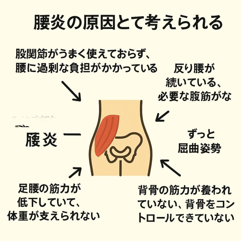 腰痛の原因を腰を中心に示した原因マップ図解。股関節、腹横筋、姿勢習慣などを矢印で表示。